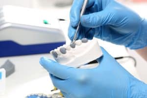 טיפול בפגמים בשיניים באמצעות ציפוי שיניים